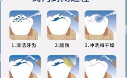 窝沟封闭操作方法的具体步骤是怎样的？操作中如何把握酸蚀时间与光照强度以确保封闭效果？