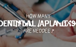 2025种植牙到底需要几个种植体？