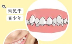 有虎牙怎么做牙齿矫正