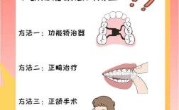 下颌后缩矫正方法有哪些？哪种更有效？