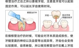 坏牙的处理方法