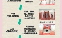 口腔种植的正确方法究竟该如何正确操作？