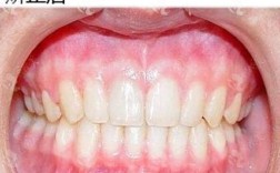 格莱美口腔牙齿矫正效果如何？靠谱吗？