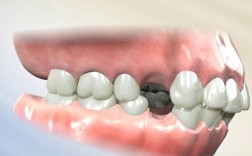 拔牙矫正会导致牙齿松动吗？