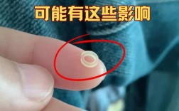 矫正橡皮筋误吃了会怎样？需要处理吗？