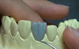 在口腔修复全冠蜡制作中，如何通过堆塑、雕刻技巧确保蜡型与患牙的精准适配及功能稳定性？