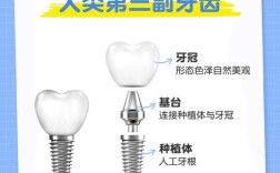 牙齿缺失后，哪些情况必须通过种牙解决？补牙和镶牙无法替代时，种牙是唯一选择吗？