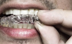 常州隐形透明正畸