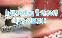 牙齿矫正器效果到底好不好？矫正后效果能维持多久？值得尝试吗？