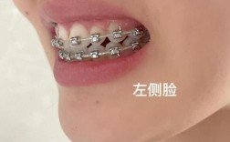 南宁矫正牙齿哪里最好？专业机构如何挑选？