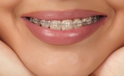 牙齿锁合矫正一般需要多久完成？