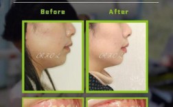 北京王府井口腔正畸