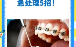 正畸结扎丝方法图解，如何通过图解掌握正确操作步骤？