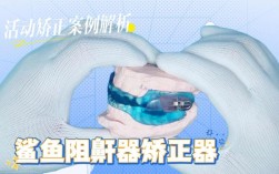 妃她正畸活动矫正器