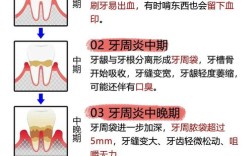 正畸期间患上牙周炎，该如何应对和处理？