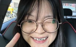 牙齿矫正后脸变歪？是矫正方式不当还是其他原因造成的？