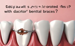 蛀牙未治好,牙齿矫正能做吗?会有影响吗?