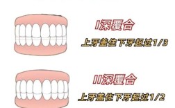 深覆合矫正有哪些方法？哪种更安全有效？