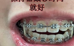 牙齿矫正之后会反弹吗？