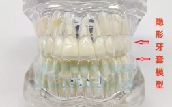 口腔正畸模型制取需满足哪些关键要求？