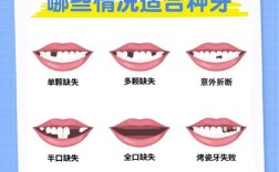 种植牙上最多能种几颗？单颗种植体能支撑多颗牙吗？