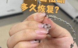 正畸期间牙齿松动是正常现象吗？原因是什么，会影响牙齿健康和矫正效果吗？