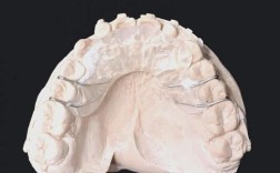 牙齿正畸导板图片