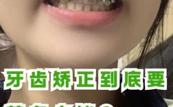 南通矫正牙齿便宜点，怎么找性价比高的方案？