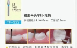 牙体预备光滑连续的方法