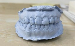 矫正牙齿为什么要做牙模？关键作用究竟是什么？