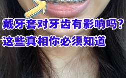 牙齿矫正器佩戴时会掉下来吗？