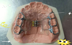 正畸扩弓骑士弓