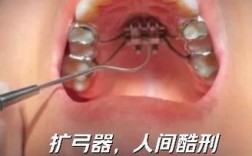南京口腔正畸挂号