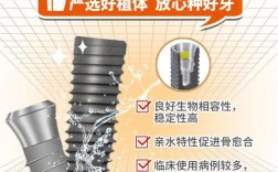 瑞士iti种植牙优缺点有哪些？