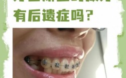 25岁牙齿矫正危害多？风险需警惕哪些？
