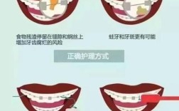 正畸期间牙齿护理有哪些常见误区？掌握哪些正确清洁方法才能避免牙套脸和蛀牙？
