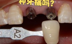 种牙需要打麻药吗？手术过程会有疼痛感吗？