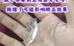 牙齿矫正戴平导疼吗？