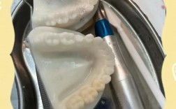 临时冠间接制作方法详解，步骤、材料及注意事项有哪些？