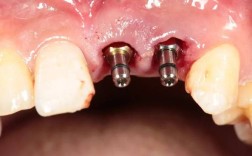 宁波口腔医院种牙效果好不好？技术是否先进？医生团队是否专业？收费标准是否透明？值得信赖吗？