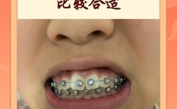 孩子矫正牙齿图片能直观看出矫正效果吗？