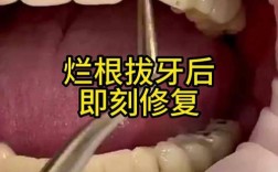 牙根完全缺失后，种植牙还有可能吗？需要满足哪些条件才能成功种牙？