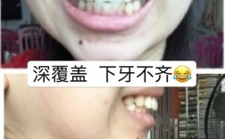 颌面正畸前后对比图，效果变化究竟有多显著？