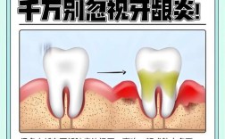 上火了牙疼怎么治疗方法