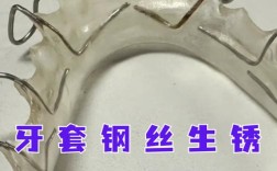 正畸钢丝断了怎么办？正确处理方法是什么？