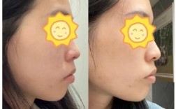 长沙美莱牙齿正畸效果好不好？值得信赖吗？