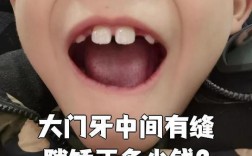 矫正牙齿门牙为何有缝隙？正常吗？需处理吗？