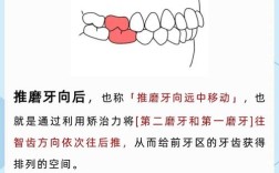 纠正牙齿的方法有哪些？如何选择适合自己的矫正方式？