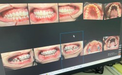 深圳康圆牙齿矫正医院