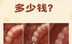 南宁那里种牙好